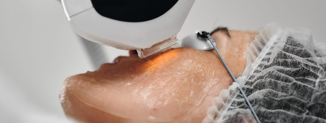 A person undergoing laser therapy on their face for skin rejuvenation.
